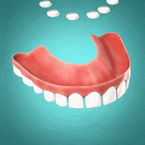 🌸 ZZEZHI™ Silicone Reline Denture Set🌿 (✨BUY 2 GET 1 FREE💕)
