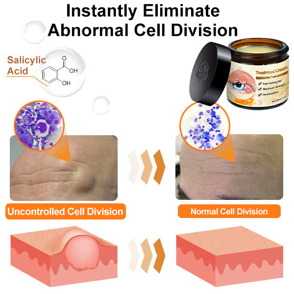 β¨γSkin Specialistγπ«ZZEZHIβ’ Turmeric & Salicylic Skin Treatment Cream π₯ππ’π¦π’πππ ππ’π¦π 7π% ππ
π
π₯(ππ¨ π’π«π«π’ππππ’π¨π§, ππ¨ π©ππ’π§)