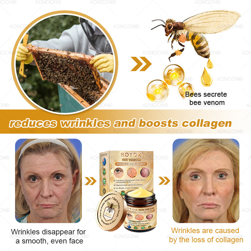 Mayo Clinic Official: 🐝ADNOON®Botox Skin Treatment Cream Anti-aging, Hydrating, Skin Repair, Even Tone, Acne and Dark Spot Treatment, Wart and Mole Removal, Psoriasis Relief🧑⚕️