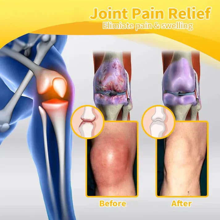 💧🐝ADNOON™ Magnesium Oil & Bee Venom Joint Healing Spray👨⚕️Australian Orthopaedic Association (AOA)
