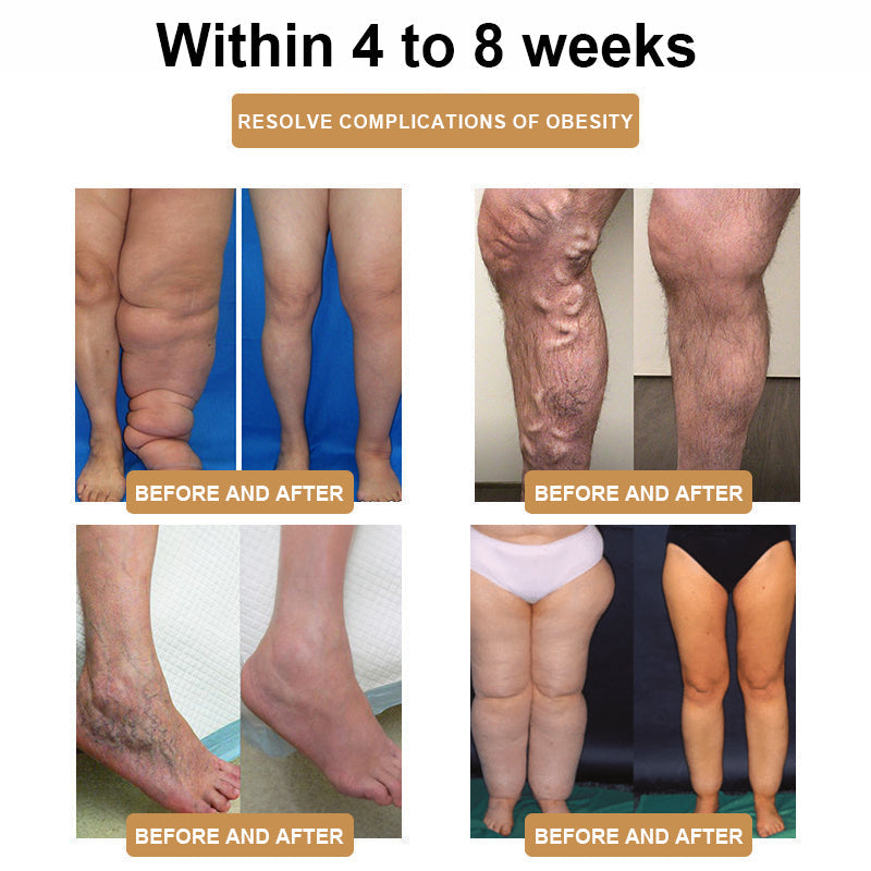 ✈️✈️2024's Newest SlimPulse™ 𝗨𝗹𝘁𝗿𝗮𝘀𝗼𝗻𝗶𝗰 𝗙𝗮𝘁 𝗕𝗹𝗮𝘀𝘁𝗶𝗻𝗴 𝗮𝗻𝗱 𝗗𝗲𝘁𝗼𝘅𝗶𝗻𝗴 𝗪𝗿𝗶𝘀𝘁𝗯𝗮𝗻𝗱 - Energy Balance 🎁 (Limited Time Discount + Doctor Recommended)