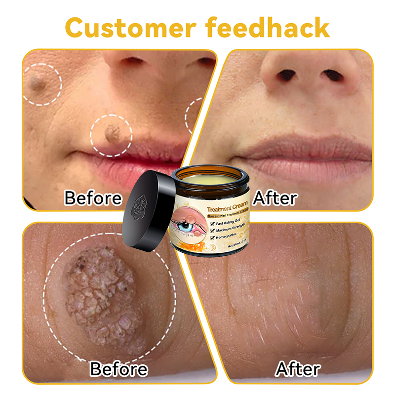 β¨γSkin Specialistγπ«ZZEZHIβ’ Turmeric & Salicylic Skin Treatment Cream π₯ππ’π¦π’πππ ππ’π¦π 7π% ππ
π
π₯(ππ¨ π’π«π«π’ππππ’π¨π§, ππ¨ π©ππ’π§)