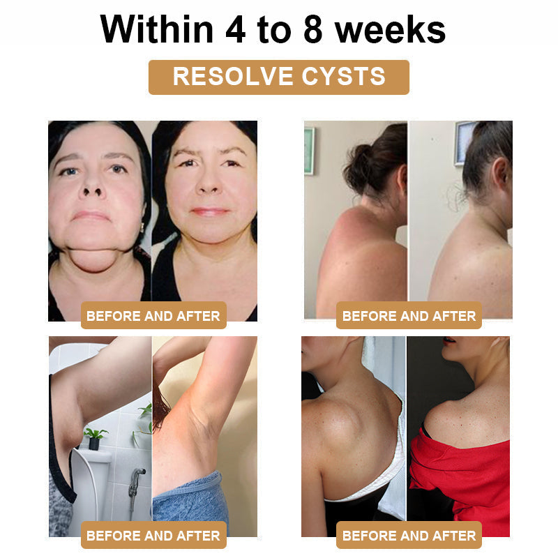 ✈️✈️2024's Newest SlimPulse™ 𝗨𝗹𝘁𝗿𝗮𝘀𝗼𝗻𝗶𝗰 𝗙𝗮𝘁 𝗕𝗹𝗮𝘀𝘁𝗶𝗻𝗴 𝗮𝗻𝗱 𝗗𝗲𝘁𝗼𝘅𝗶𝗻𝗴 𝗪𝗿𝗶𝘀𝘁𝗯𝗮𝗻𝗱 - Energy Balance 🎁 (Limited Time Discount + Doctor Recommended)