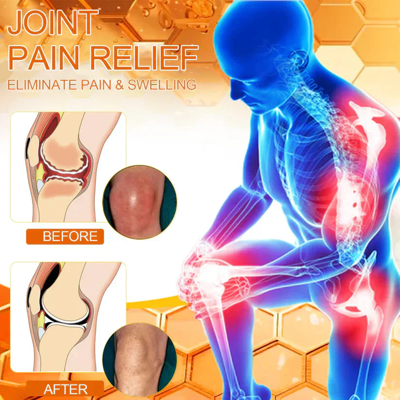 💧🐝ADNOON™ Magnesium Oil & Bee Venom Joint Healing Spray👨⚕️Australian Orthopaedic Association (AOA)