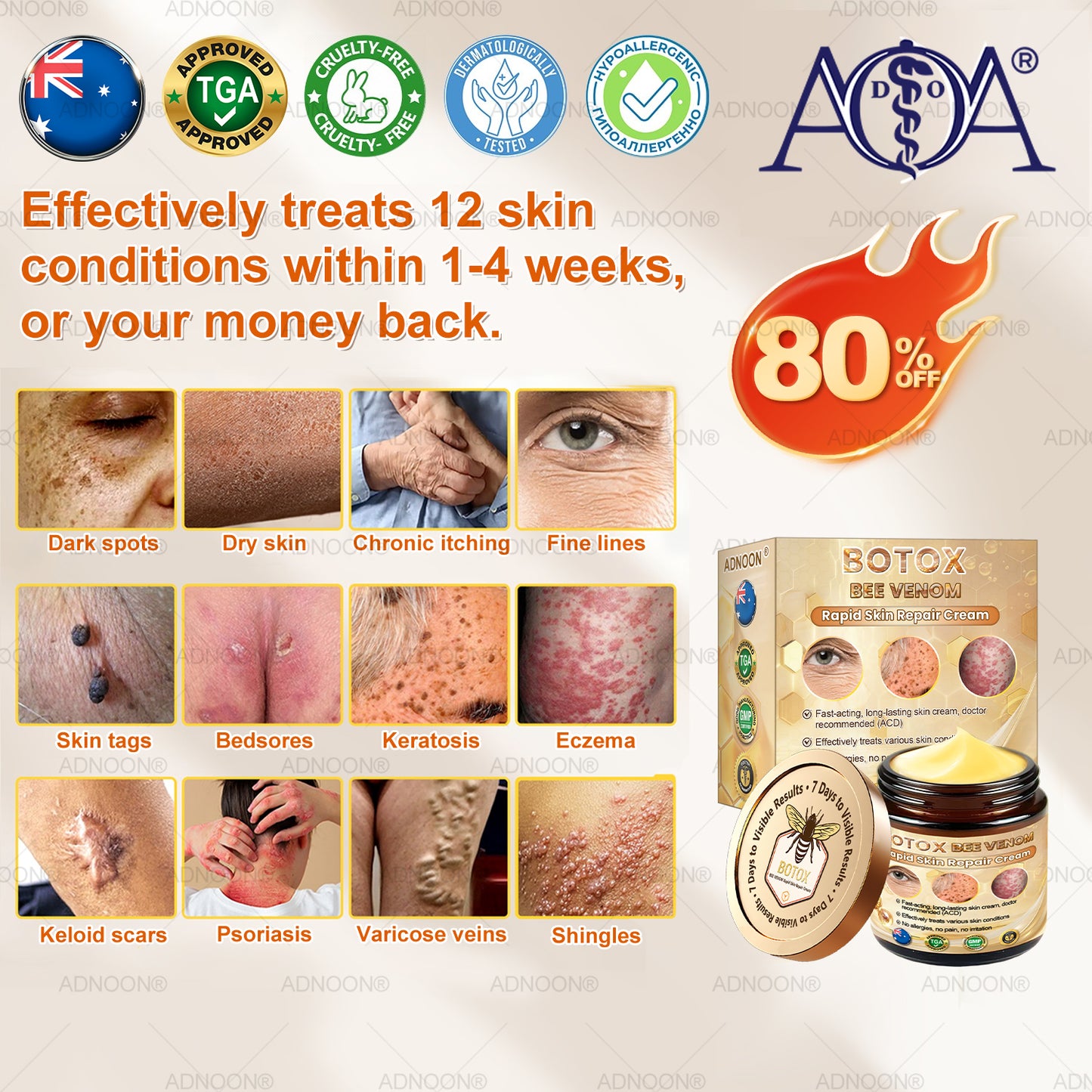 Mayo Clinic Official: 🐝ADNOON®Botox Skin Treatment Cream Anti-aging, Hydrating, Skin Repair, Even Tone, Acne and Dark Spot Treatment, Wart and Mole Removal, Psoriasis Relief🧑⚕️