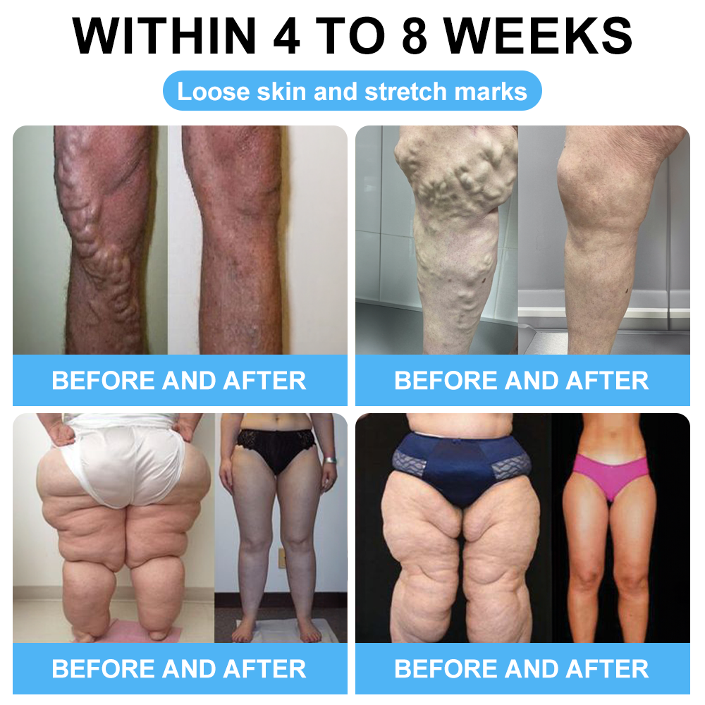 🎁Only 5 pieces left! We're offering you an additional 50% discount! Get yourself in shape and healthy. Miss out now, and you won't have another chance until next year.