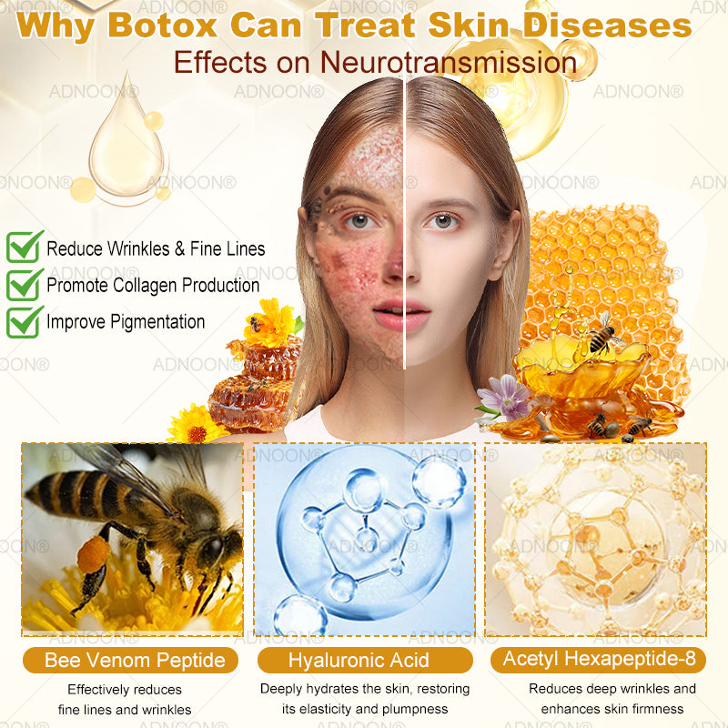 Mayo Clinic Official: 🐝ADNOON®Botox Skin Treatment Cream Anti-aging, Hydrating, Skin Repair, Even Tone, Acne and Dark Spot Treatment, Wart and Mole Removal, Psoriasis Relief🧑⚕️