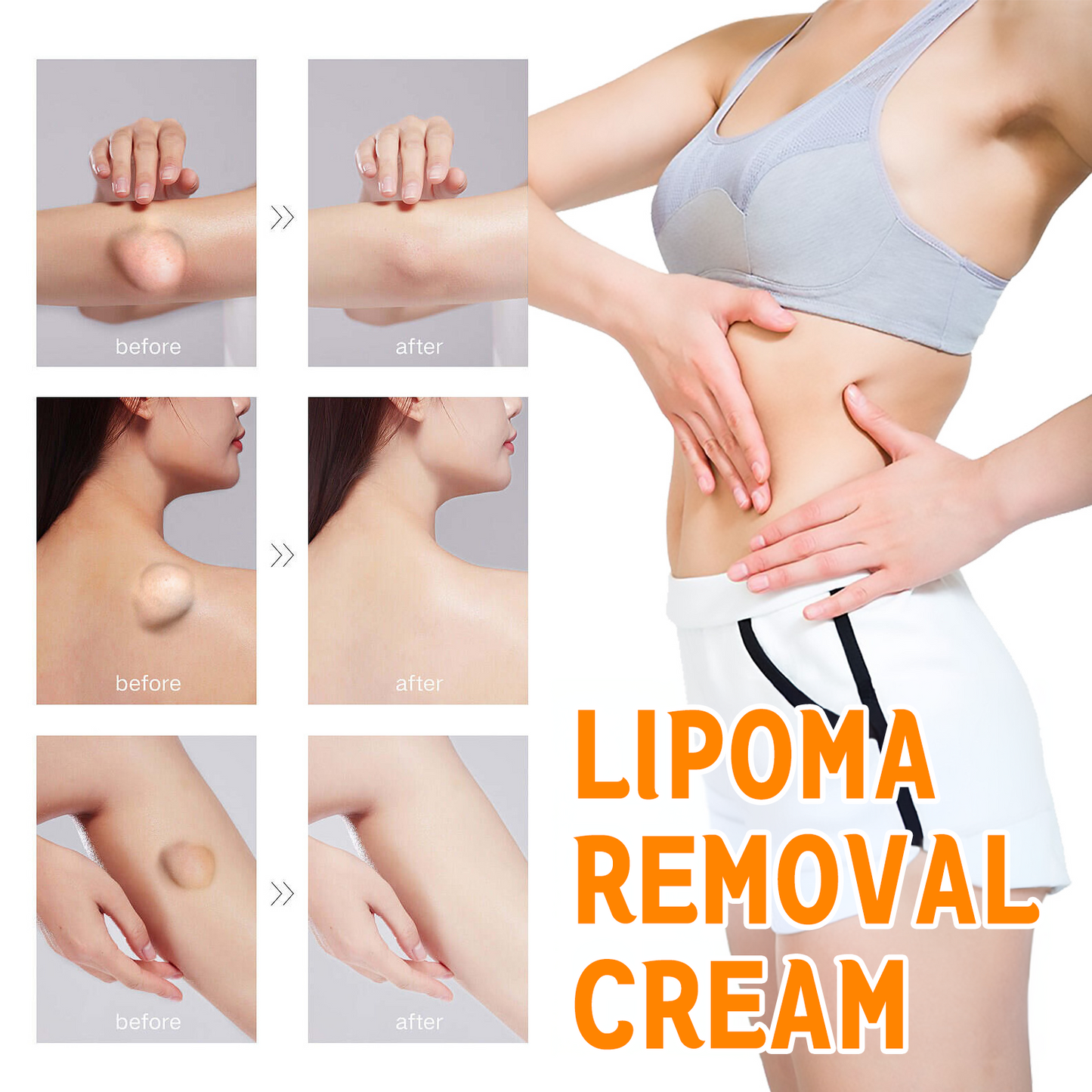 β¨γSkin Specialistγπ«ZZEZHIβ’ Turmeric & Salicylic Skin Treatment Cream π₯ππ’π¦π’πππ ππ’π¦π 7π% ππ
π
π₯(ππ¨ π’π«π«π’ππππ’π¨π§, ππ¨ π©ππ’π§)