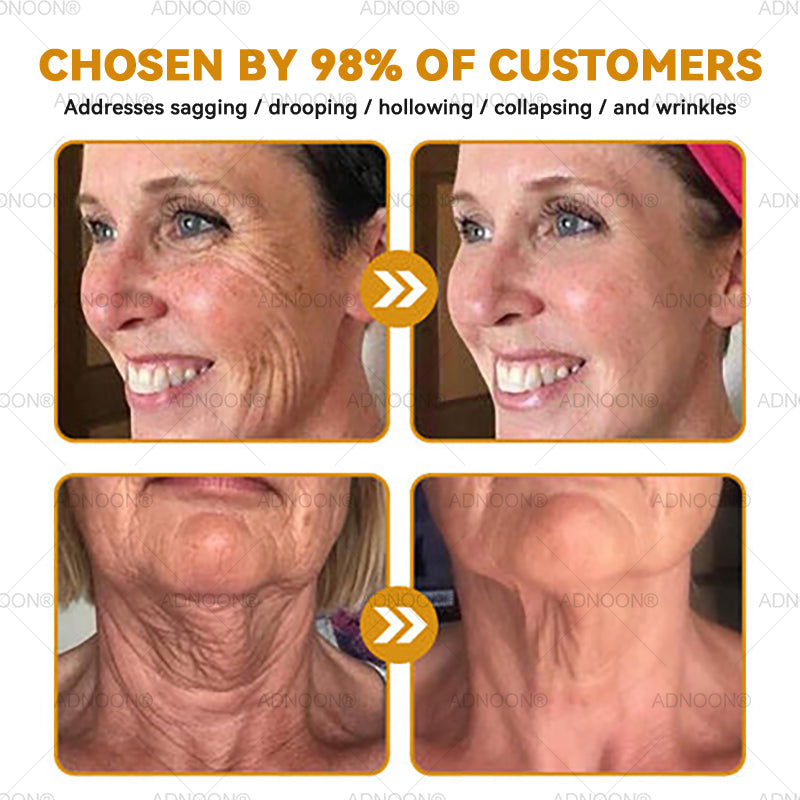 Mayo Clinic Official: 🐝ADNOON®Botox Skin Treatment Cream Anti-aging, Hydrating, Skin Repair, Even Tone, Acne and Dark Spot Treatment, Wart and Mole Removal, Psoriasis Relief🧑⚕️