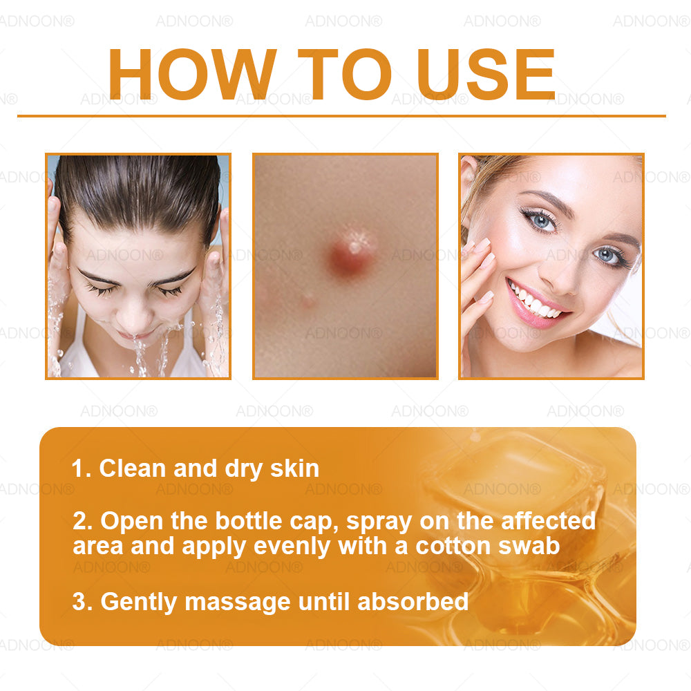 Mayo Clinic Official: 🐝ADNOON®Botox Skin Treatment Cream Anti-aging, Hydrating, Skin Repair, Even Tone, Acne and Dark Spot Treatment, Wart and Mole Removal, Psoriasis Relief🧑⚕️
