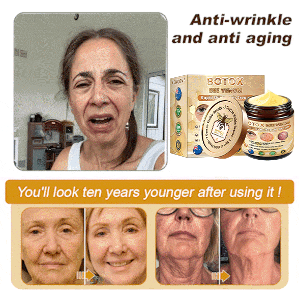 Mayo Clinic Official: 🐝ADNOON®Botox Skin Treatment Cream Anti-aging, Hydrating, Skin Repair, Even Tone, Acne and Dark Spot Treatment, Wart and Mole Removal, Psoriasis Relief🧑⚕️