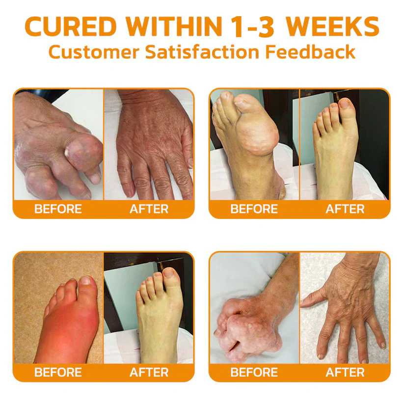 💧🐝ADNOON™ Magnesium Oil & Bee Venom Joint Healing Spray👨⚕️Australian Orthopaedic Association (AOA)