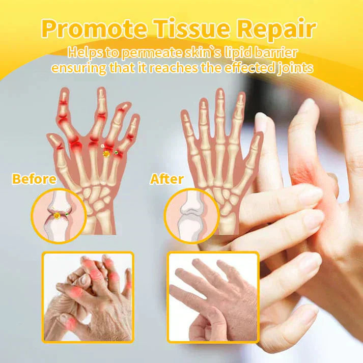 💧🐝ADNOON™ Magnesium Oil & Bee Venom Joint Healing Spray👨⚕️Australian Orthopaedic Association (AOA)