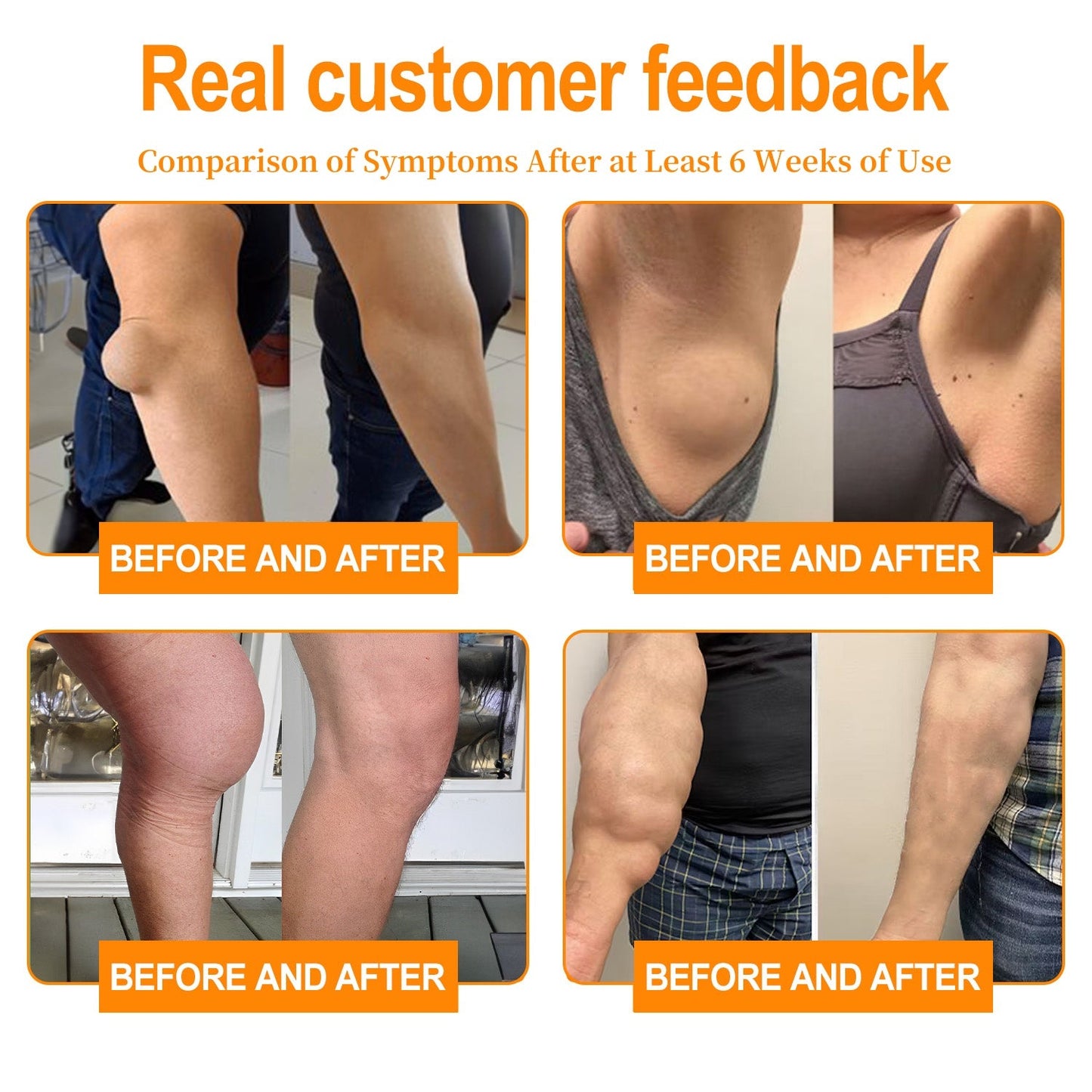 🎁 Only 5 boxes left! We're offering you an additional 50% discount! Get yourself in shape and healthy. Miss out now, and you won't have another chance until next year.
