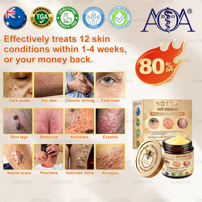 Mayo Clinic Official: 💐🐝ADNOON®Botox Skin Treatment Cream Anti-aging, Hydrating, Skin Repair, Even Tone, Acne and Dark Spot Treatment, Wart and Mole Removal, Psoriasis Relief🧑‍⚕️