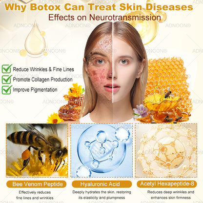 Mayo Clinic Official: 💐🐝ADNOON®Botox Skin Treatment Cream Anti-aging, Hydrating, Skin Repair, Even Tone, Acne and Dark Spot Treatment, Wart and Mole Removal, Psoriasis Relief🧑‍⚕️