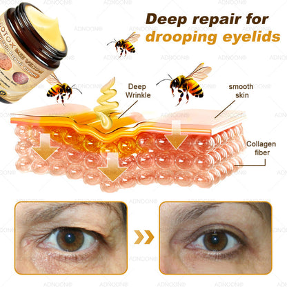 Mayo Clinic Official: 💐🐝ADNOON®Botox Skin Treatment Cream Anti-aging, Hydrating, Skin Repair, Even Tone, Acne and Dark Spot Treatment, Wart and Mole Removal, Psoriasis Relief🧑‍⚕️