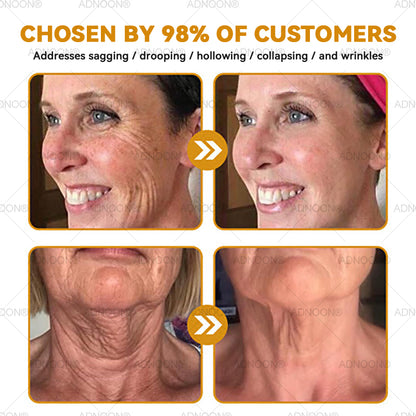 Mayo Clinic Official: 💐🐝ADNOON®Botox Skin Treatment Cream Anti-aging, Hydrating, Skin Repair, Even Tone, Acne and Dark Spot Treatment, Wart and Mole Removal, Psoriasis Relief🧑‍⚕️