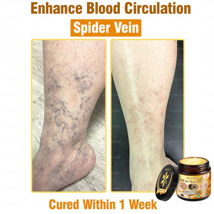Official Store✅ADNOON®🌸 Multi-Effect All-in-One Skincare Cream👨‍⚕️ Certified by The Australasian College of Dermatologists (ACD) (Treating Skin Cancer, Eczema, Acne, Warts, Psoriasis, Wrinkles, Scars, and Varicose Veins)
