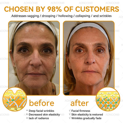 Mayo Clinic Official: 💐🐝ADNOON®Botox Skin Treatment Cream Anti-aging, Hydrating, Skin Repair, Even Tone, Acne and Dark Spot Treatment, Wart and Mole Removal, Psoriasis Relief🧑‍⚕️