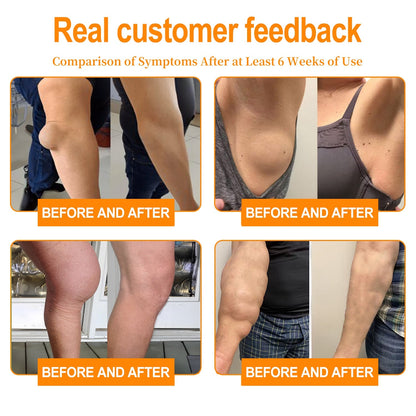 🎁 Only 5 boxes left! We're offering you an additional 50% discount! Get yourself in shape and healthy. Miss out now, and you won't have another chance until next year.